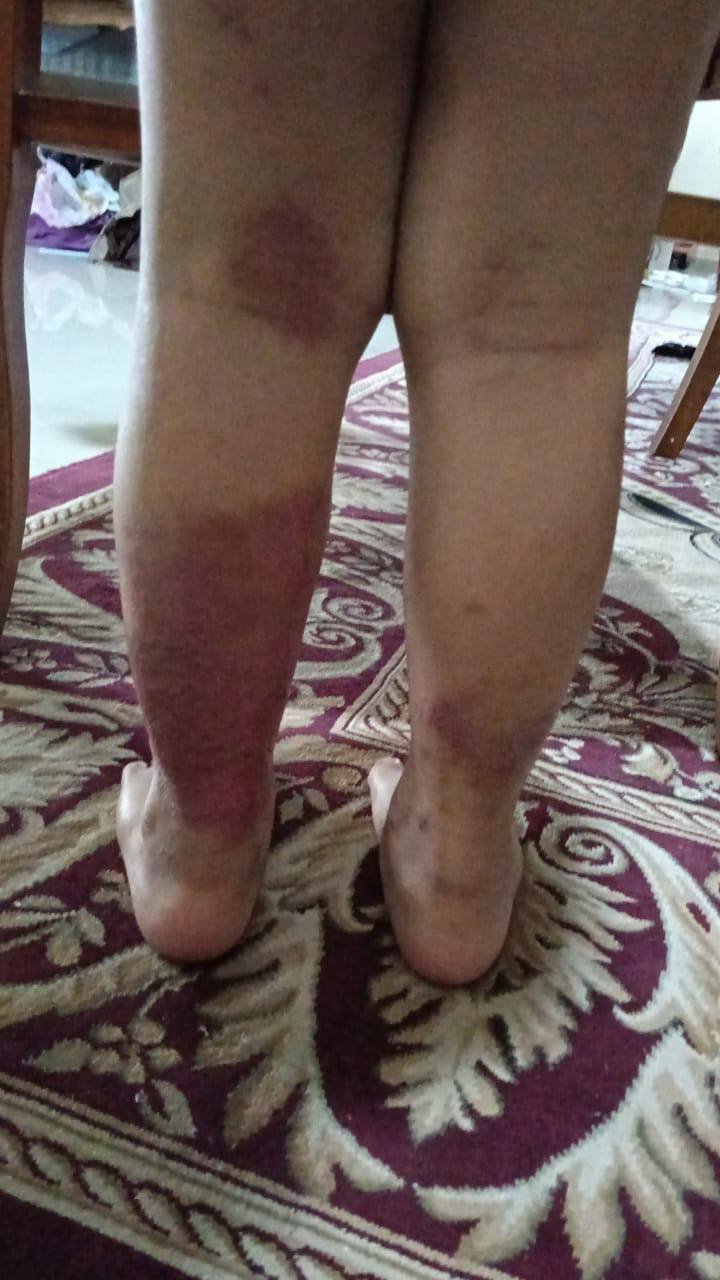 Keadaan kulit sebelum, gambar 1