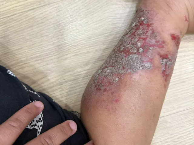 Gambar pelanggan sebelum guna